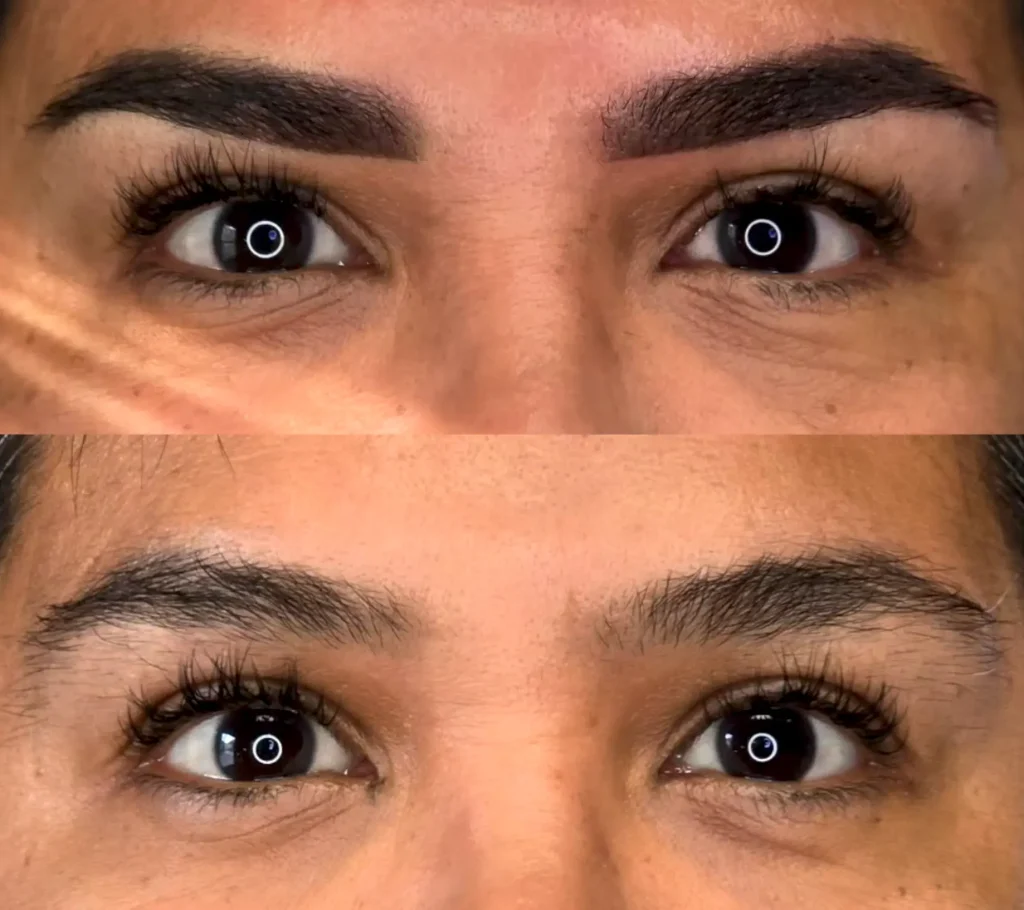 Cosmetic Tattoo